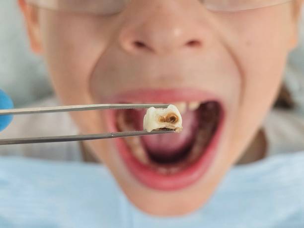 Best Pediatric Emergency Dentist in Bawcomville, LA
